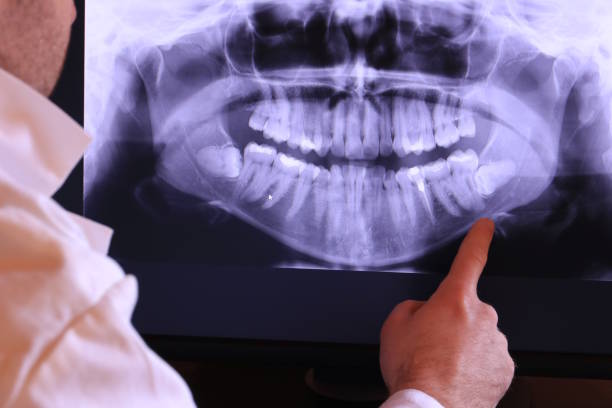 Best After-Hours Emergency Dentist in Mound Bayou, MS