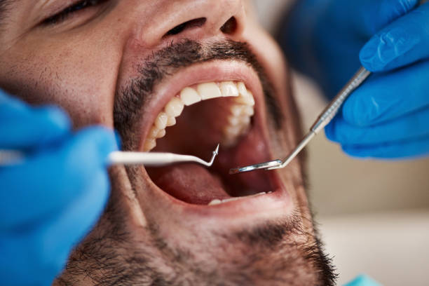 Best Emergency Tooth Extraction in Mound Bayou, MS