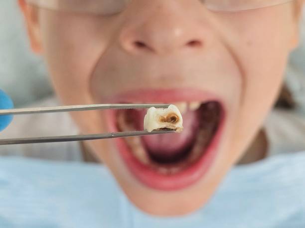 Professional Emergency Dentist in MS