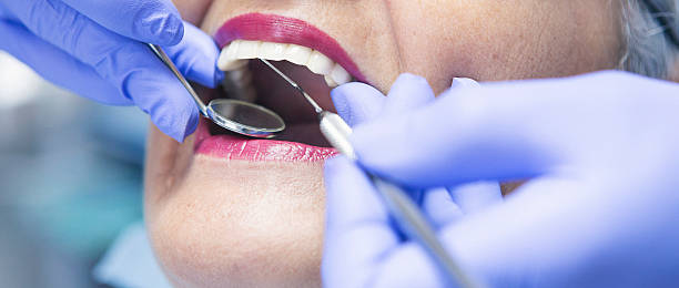 Best Emergency Root Canal Treatment in Mound Bayou, MS