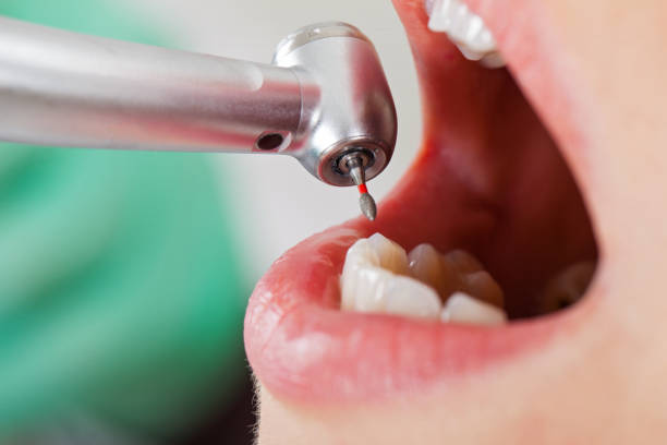 Best Walk-In Emergency Dentist in Mound Bayou, MS